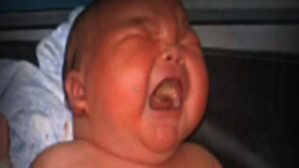 Narodziny dzieci-gigantów