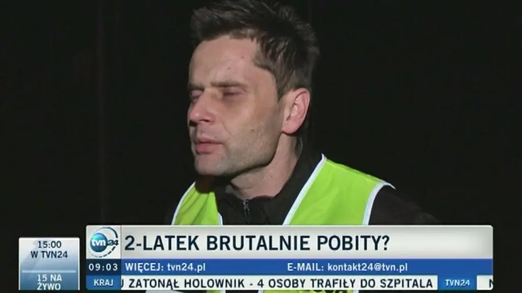Pobity dwulatek trafił do szpitala. "Powiedział, że dziecko upadło mu, gdy je przebierał"