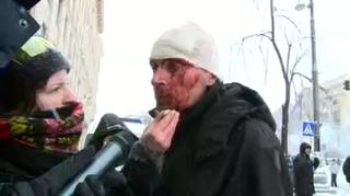 Protestujący dostał kamieniem. "Milicjanci rzucali w nas, a my w nich"