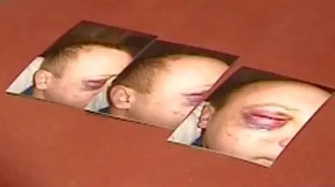 Skatowany na komisariacie?