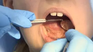 "Jedno na troje dzieci ma uraz zębów." Czego jeszcze nie wiedzą rodzice