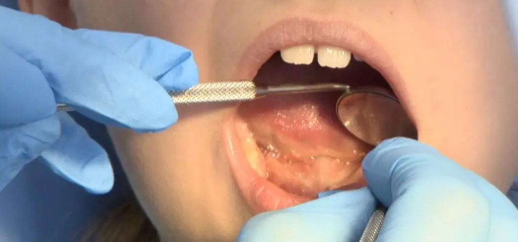 "Jedno na troje dzieci ma uraz zębów." Czego jeszcze nie wiedzą rodzice