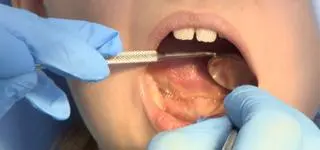 "Jedno na troje dzieci ma uraz zębów." Czego jeszcze nie wiedzą rodzice