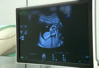 "Czasami rozpoznajemy chorobę już w trakcie USG"