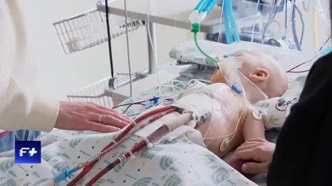 Trzymiesięczni chłopcy walczą o życie. Czekają na ratunek