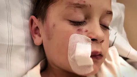 Pogryzieni. Życie z traumą