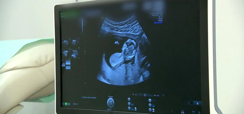"Najmłodszy pacjent? Jeszcze się nie narodził"