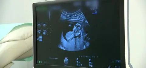 "Czasami rozpoznajemy chorobę już w trakcie USG"