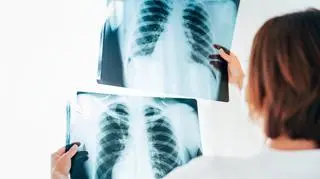 W razie wystąpienia objawów należy skontaktować się z lekarzem.