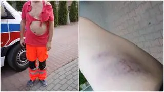 Pobicie ratowników