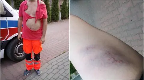 Pobicie ratowników