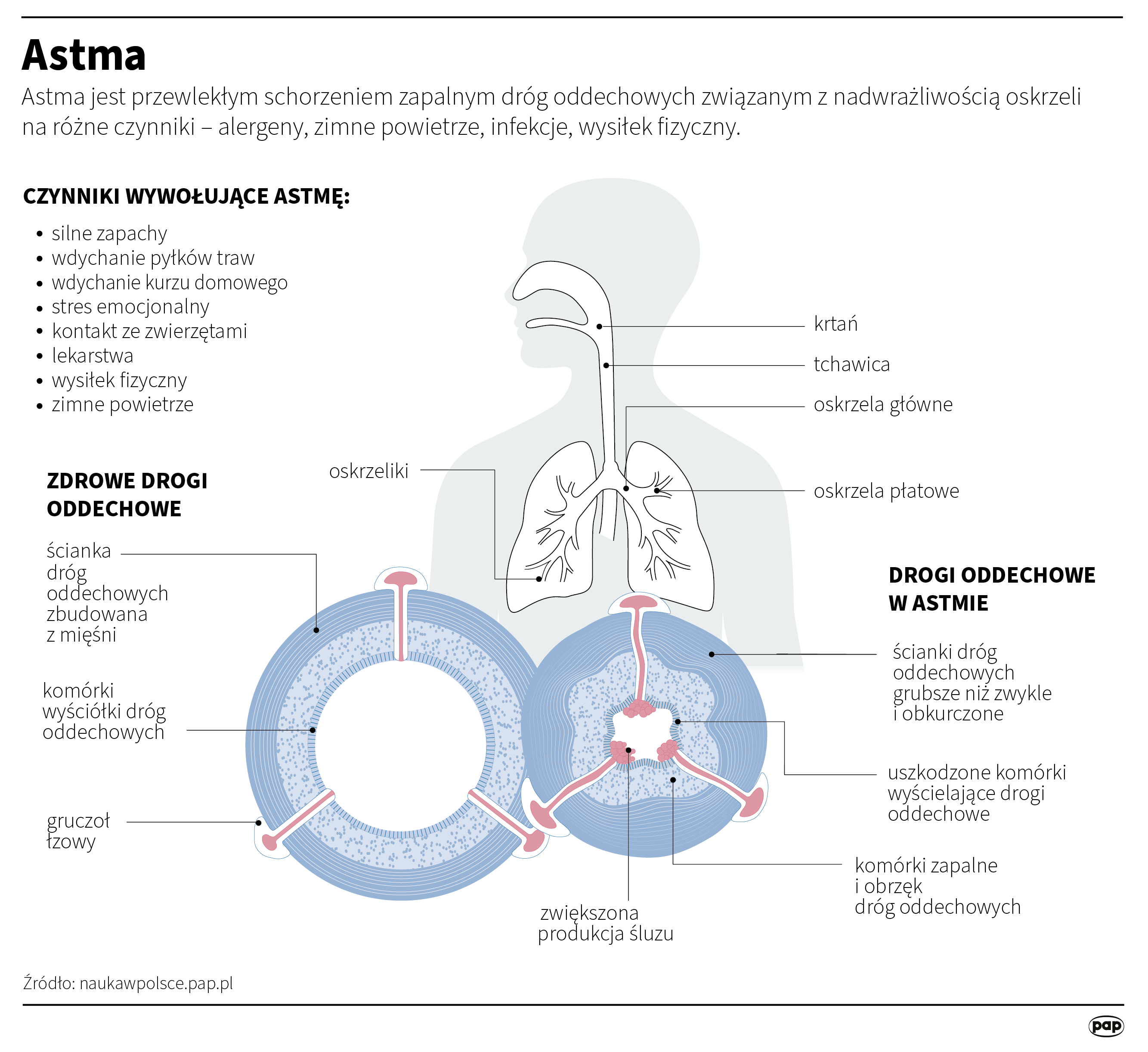 Astma