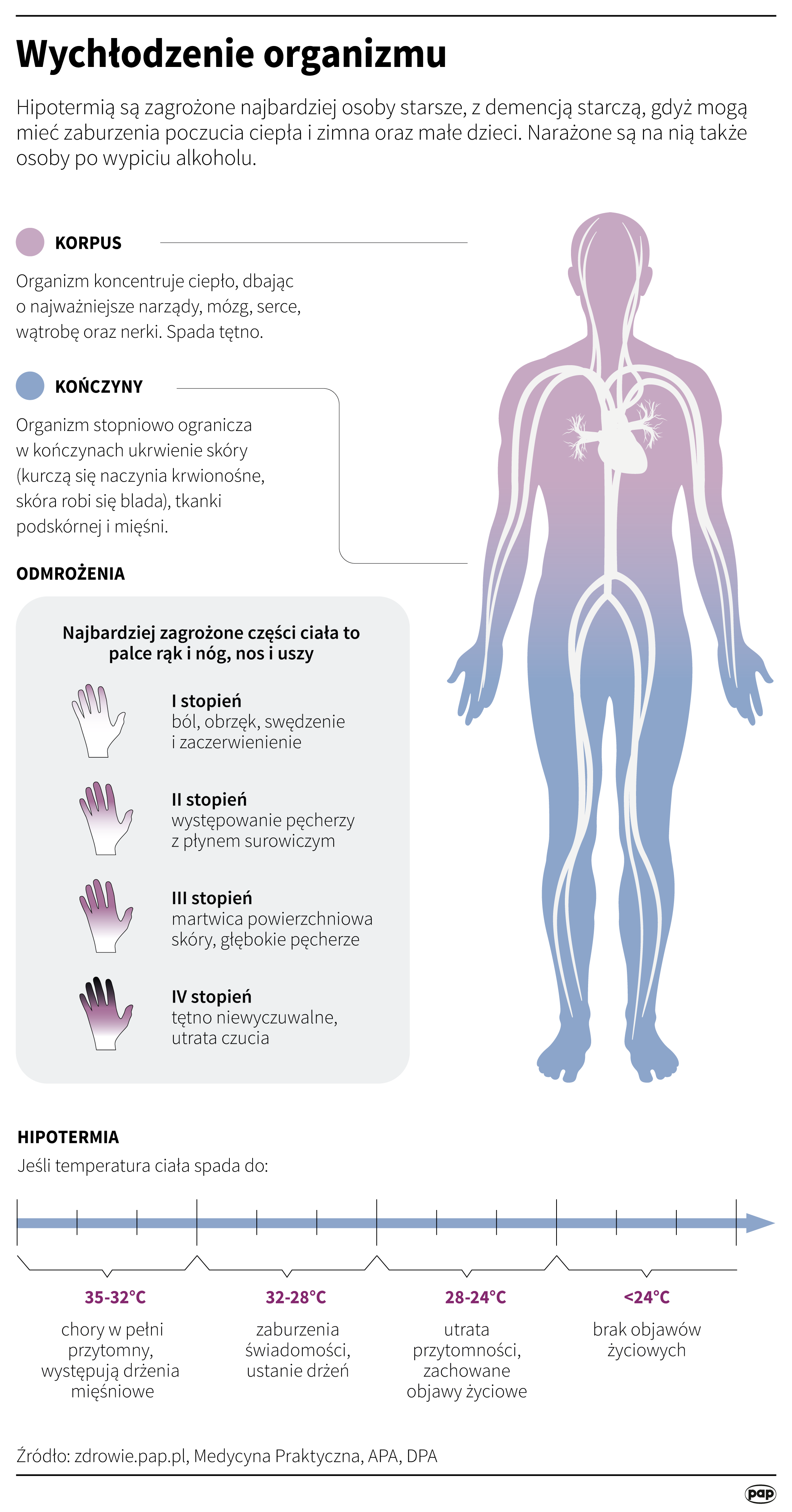 Hipotermia 