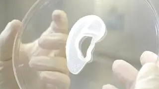 Implant ucha