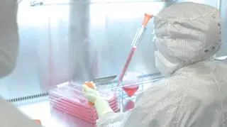 Implant został wydrukowany metodą biodruku 3D