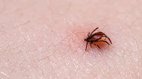 Naukowcy opracowali nowy test do wykrywania boreliozy