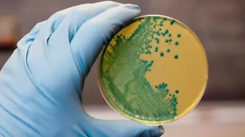 Bakteria Listeria monocytogenes