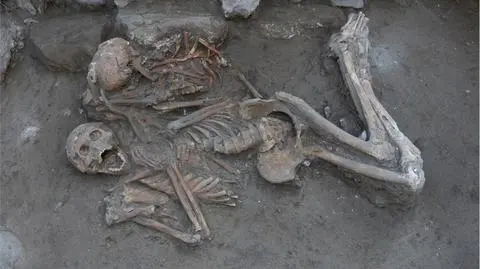 Trepanacja czaszki przeprowadzona trzy i pół tysiąca lat temu. Na co chorowali dwaj bracia