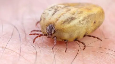 Borelioza w Polsce. Prawie trzy tysiące mniej zachorowań niż w analogicznym okresie rok temu