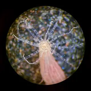 Nematostella vectensis