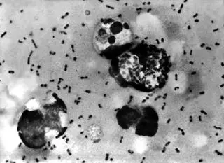 Pałeczka dżumy (Yersinia pestis)