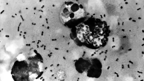 DNA z zębów pomogło ustalić, gdzie zaczęła się epidemia Czarnej Śmierci