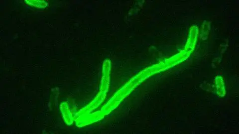 Pałeczka dżumy (Yersinia pestis) 
