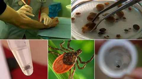 Kleszcze przenoszą się do miast. "Jesteśmy całkowicie bezbronni"