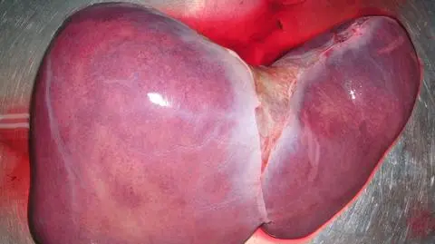 Uczonym z Jerozolimy udało się wyhodować w pełni funkcjonalne komórki wątroby