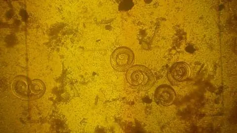 Spirale Trichinelli
