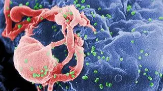 Cząsteczki wirusa HIV mają kolor zielony