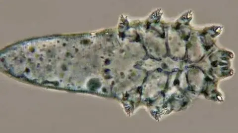 Pajęczaki w naszej skórze. Według badań ma je 100 procent dorosłych