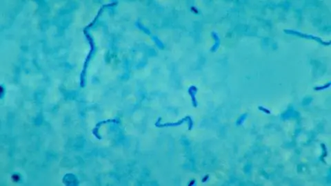 Ta bakteria może powodować zespół Lemierre'a (CDC/ Dr. Lillian V. Holdeman (public domain)