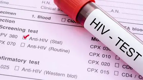 Wirus HIV zagraża Europie jak nigdy dotąd. "Alarmujące tempo epidemii"
