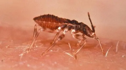 Choroba przenoszona przez "całujące robaki" groźniejsza niż sądzono