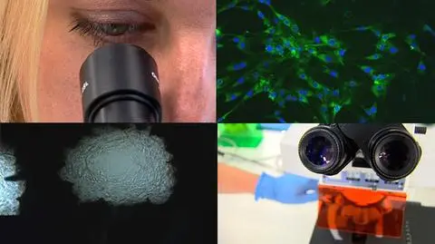 Sukces polskich naukowców: "oswoili" komórki macierzyste