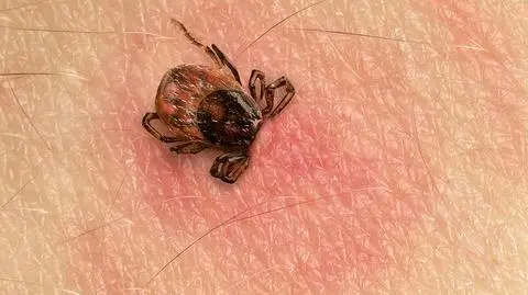 Kleszcze mogą być niebezpieczne dla naszego zdrowia