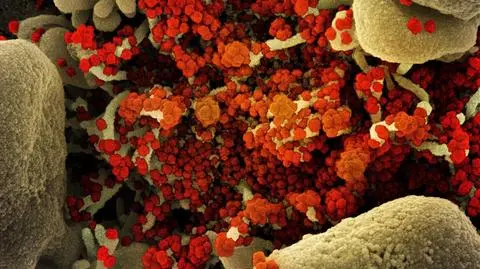 "Są tanie i łatwo dostępne". Naukowcy: kortykosteroidy ratują życie ciężko chorych na COVID-19