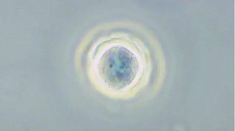 Acanthamoeba jest szczególnie niebezpieczna dla osób zażywających kąpieli wodnych w soczewkach