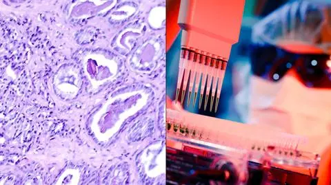 Naukowcy znaleźli piętę achillesową raka. Zamiast chemioterapii szczepionki