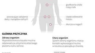 Cukrzyca (PAP/Maria Samczuk, Adam Ziemienowicz)