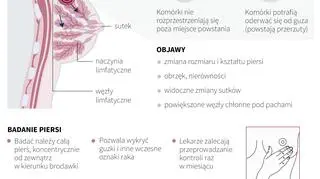 Czym jest rak piersi i jak się badać (Maria Samczuk/PAP)