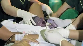 Daica Camacho, 7-miliardowy człowiek (PAP/EPA)