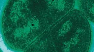 Deinococcus radiodurans (sciencescapes.co.uk)