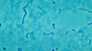 Fusobacterium necrophorum może wywołać zespół Lemierre'a (CDC/ Dr