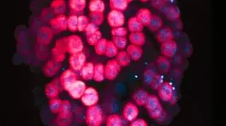 Mikroorganizmy odlanezione w jeziorze Vida (National Science Foundation/dzięki uprzejmości Priscu Research Group, Montana State University at Bozema)