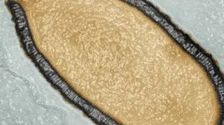 Odkryty w syberyjskiej zmarzlinie  Pithovirus sibericum jest największym znanym wirusem