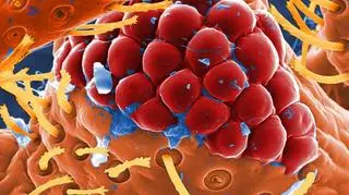 Oko pluskwy domowej (Centers of Disease Control)