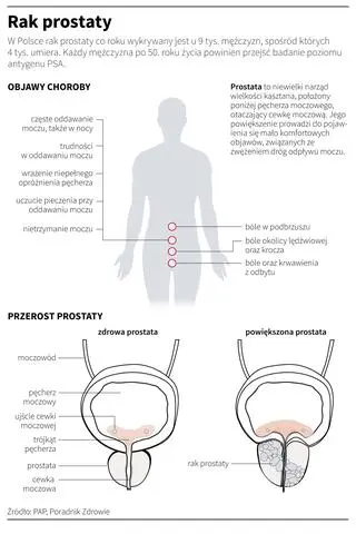 Rak prostaty (Maria Samczuk/PAP)