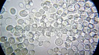 Saccharomyces cerevisiae (Wikipedia/BB-CY-SA/Bob Baylock)